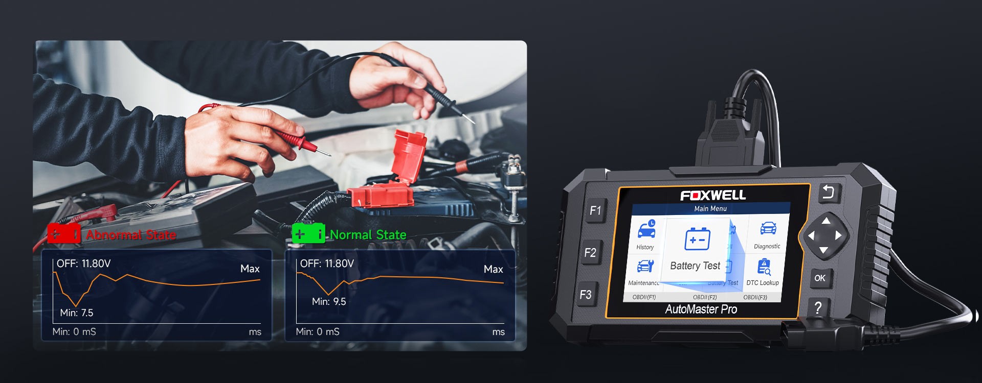 Car Brakes | Electronic Parking Brake