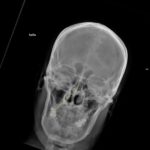 Digital X-ray machine
