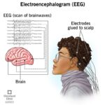 EEG Sensors