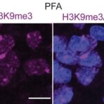 Immunofluorescence showing methylation of histones