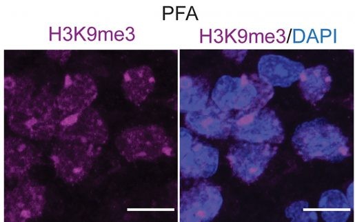 Immunofluorescence showing methylation of histones