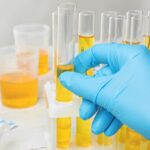 A lab technician analyzing urine samples