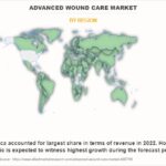 Advanced Wound Care Market by Region